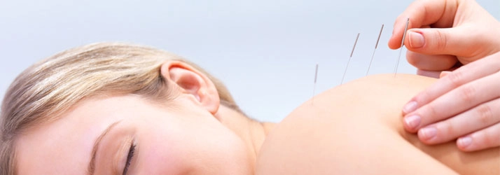 Acupuncture Flower Mound TX Back Pain Relief Acupuncture A woman laying down during acupuncture treatment.