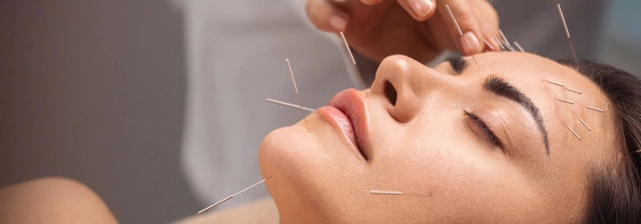 Acupuncture Flower Mound TX Cosmetic Acupuncture HERO A woman receiving cosmetic acupuncture on their face.