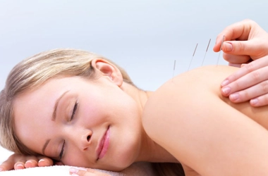 Chiropractic Flower Mound TX Acupuncture HP A woman receiving acupuncture on her shoulder blade.